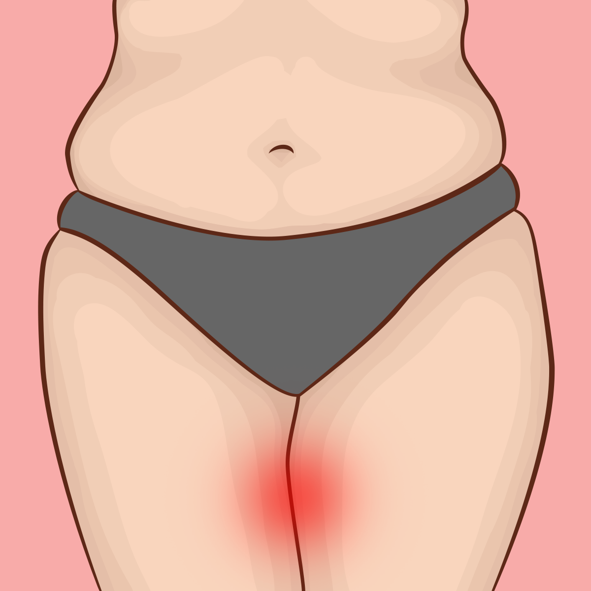 How to Care for Chafed Inner Thighs – Thigh Society Inc