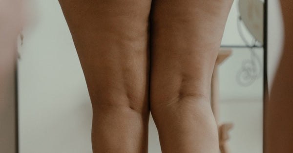 Inner Thigh Chafing 